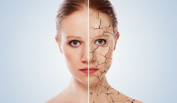 преди и след подмладяване на кожата
