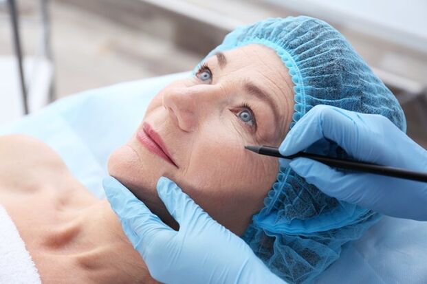 Подготовка за нехирургична процедура за лифтинг на лицето