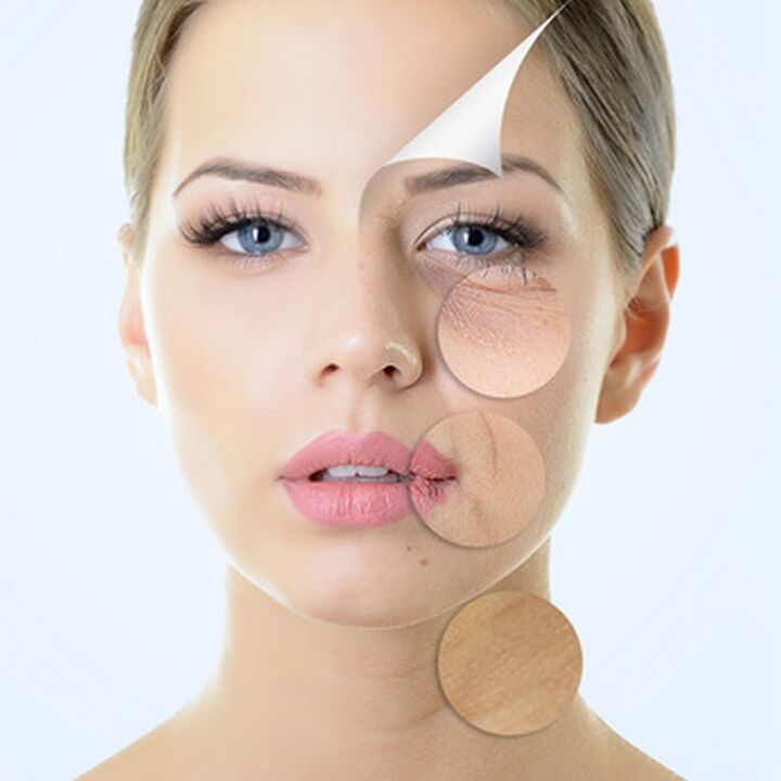 Несъвършенства по кожата на лицето - показания за процедури против стареене