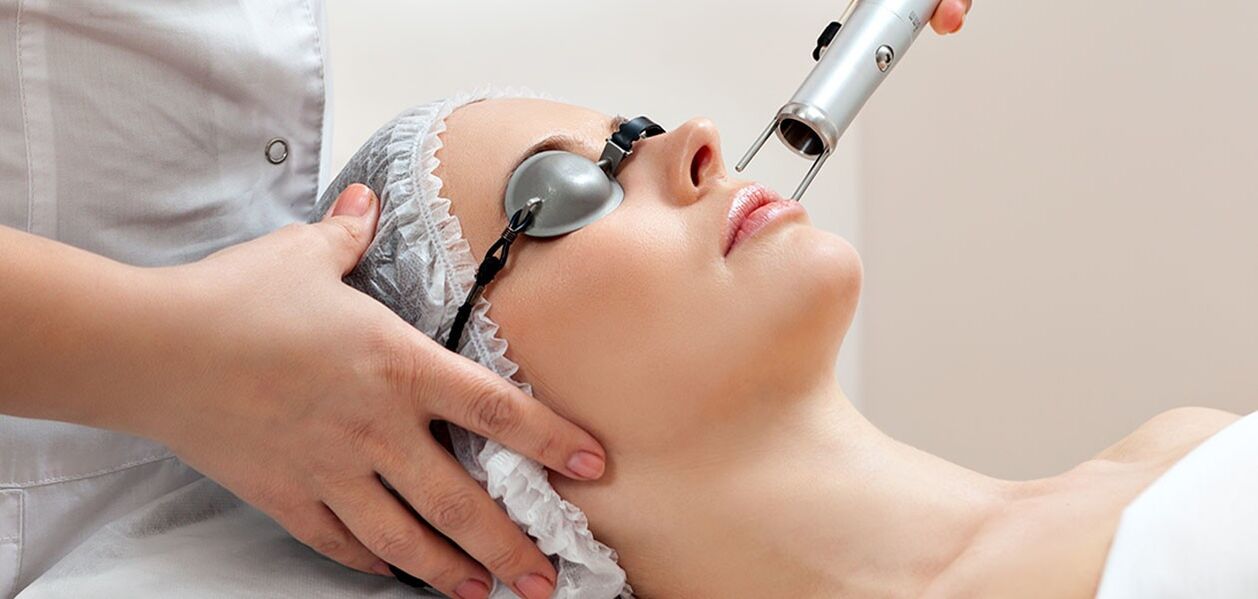 Процедура с лазерен пилинг за подмладяване на кожата на лицето